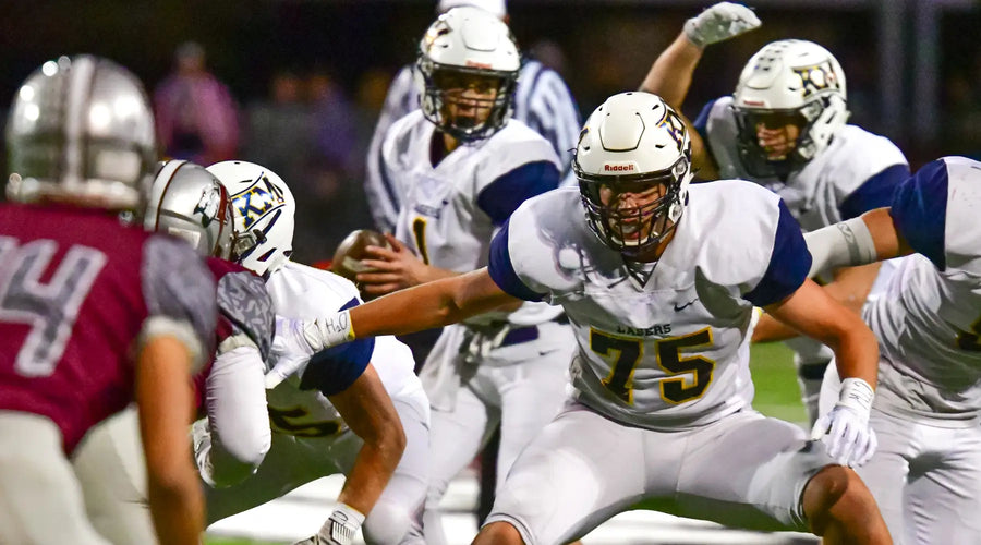 Choosing a Football Mouth Guard for Braces: What You Need to Know