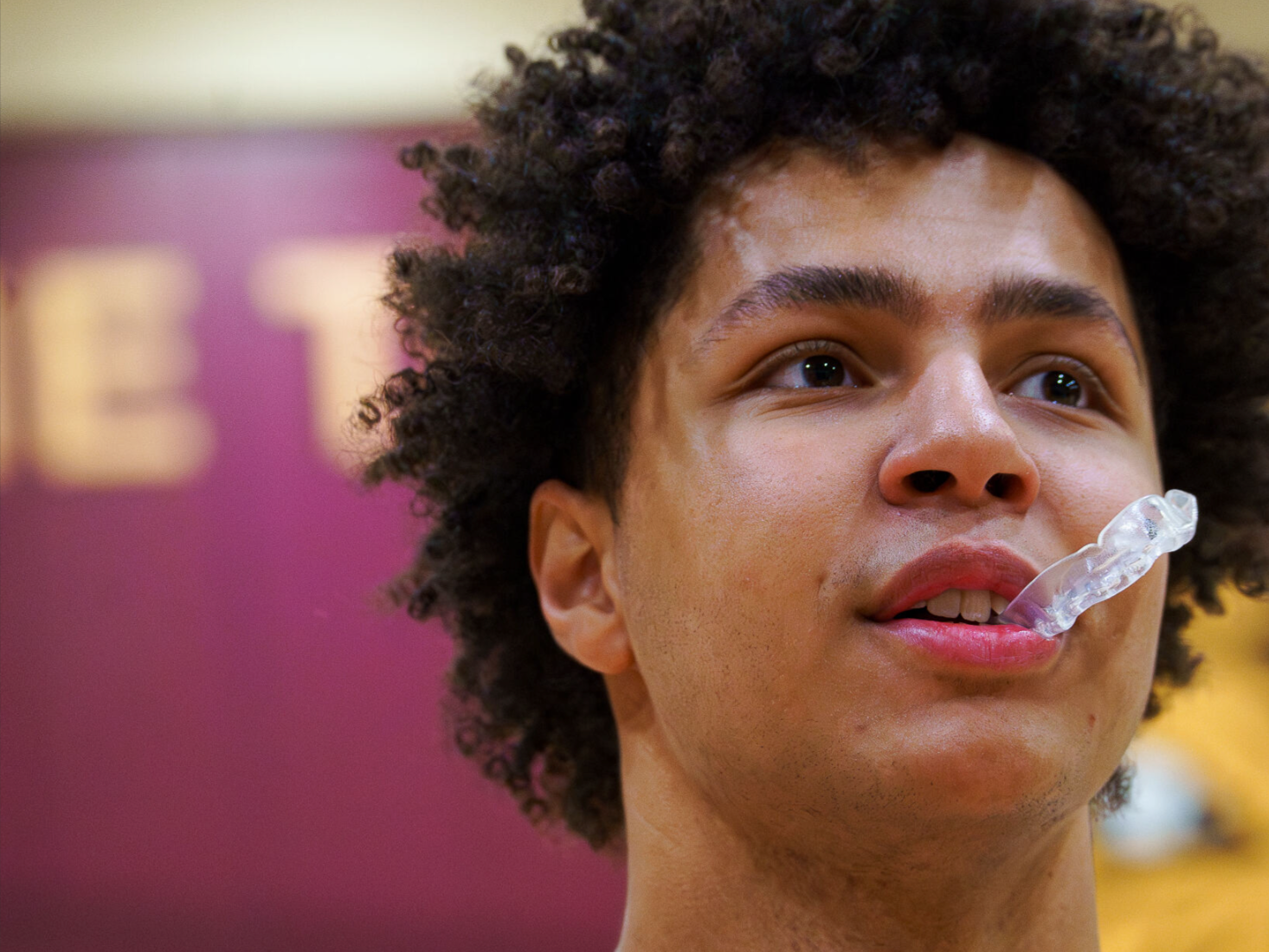 The Ultimate Guide to Clear Mouth Guards for Sports Safety